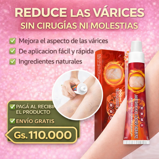 Crema para Várices – Reduce Arañitas y Mejora la Circulación | Uso Diario